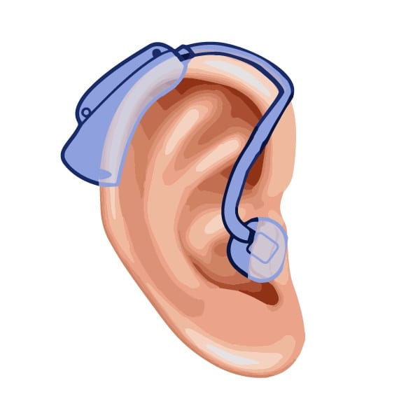 An illustrated image showing how a mini behind-the-ear hearing aid fits into the human ear