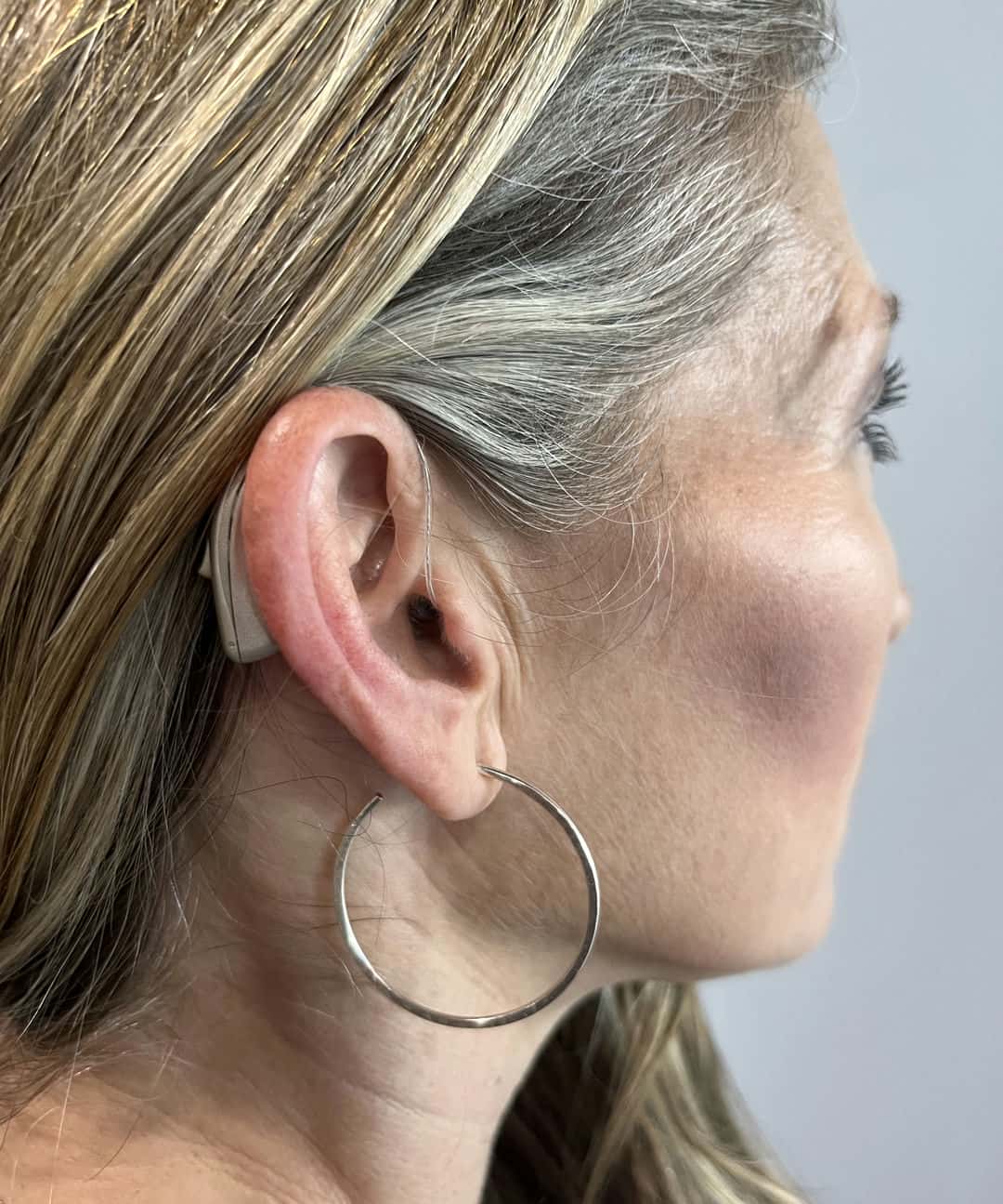 behind the ear hearing aid being worn by a woman