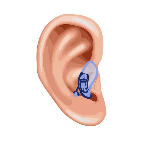 An illustrated image showing how a completely-in-the-canal hearing aid fits into the human ear