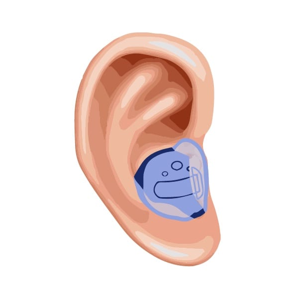 An illustrated image showing how an in-the-canal hearing aid fits into the human ear
