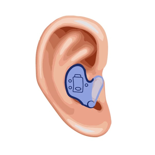 An illustrated image showing how an in-the-ear hearing aid fits into the human ear
